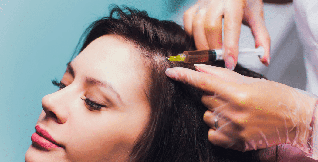 Alopecia Treatment